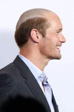 https://static.gofugyourself.com/uploads/2017/10/alexander-skarsgard-is-bald-now-102617-1509083463-240x360.jpg